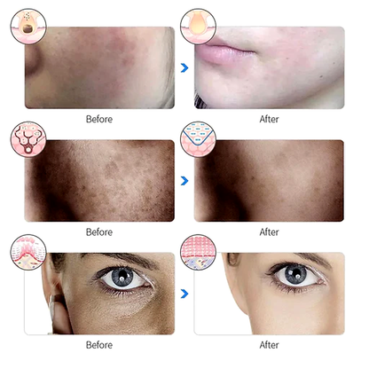 OFERTA FACTIVES - 2 Unidades 54.34€ - Máscara Facial LED Rejuvenecedora